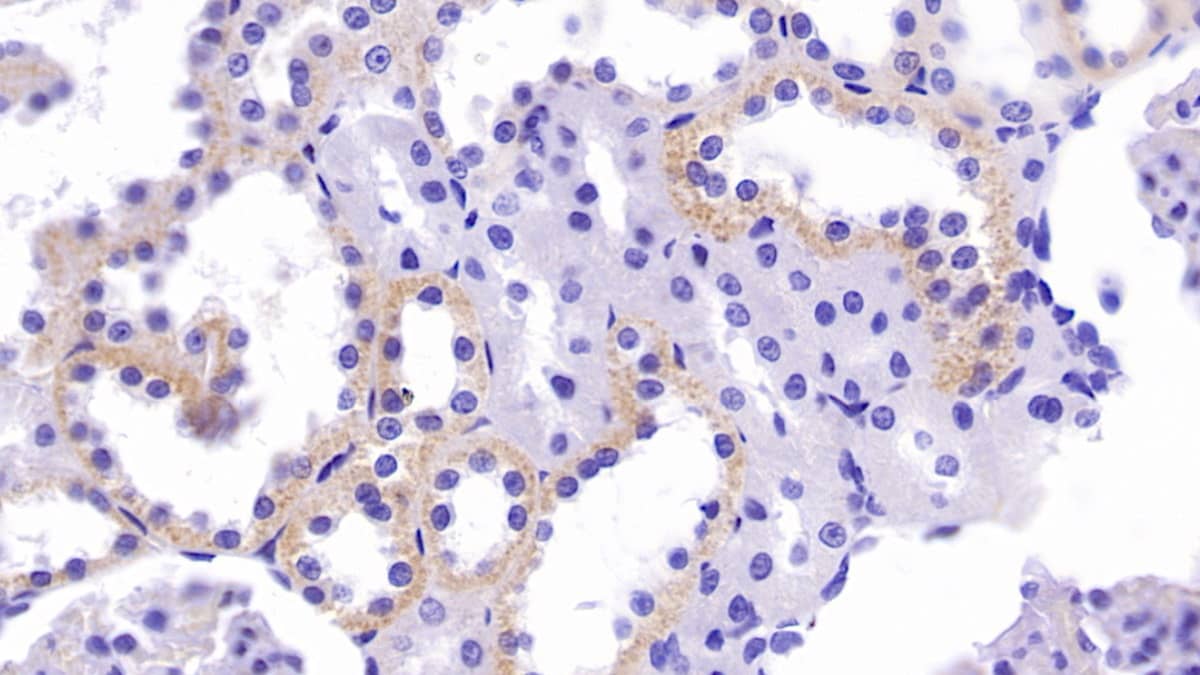 Immunohistochemistry-Paraffin: CRAT Antibody (C3) [NBP3-42150] - DAB staining on IHC-P; Sample: Rat Kidney Tissue; Primary Ab: 40ug/ml NBP3-42150; Second Ab: 2ug/mL HRP-Linked Caprine Anti-Mouse IgG Polyclonal Antibody