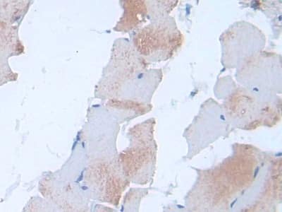 Immunohistochemistry-Paraffin: IL-24 Antibody (C5) [NBP3-42151] - DAB staining on IHC-P; Sample: Rat Skin Tissue; Primary Ab: 30ug/ml NBP3-42151; Second Ab: 2ug/mL HRP-Linked Caprine Anti-Mouse IgG Polyclonal Antibody