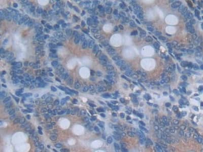 Immunohistochemistry-Paraffin: IL-24 Antibody (C6) [NBP3-42152] - DAB staining on IHC-P; Sample: Rat Small intestine Tissue; Primary Ab: 30ug/ml NBP3-42152; Second Ab: 2ug/mL HRP-Linked Caprine Anti-Mouse IgG Polyclonal Antibody