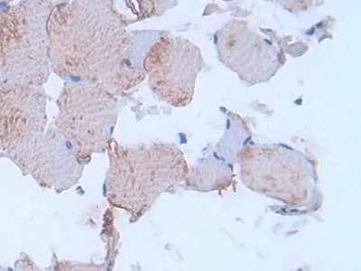 Immunohistochemistry-Paraffin: IL-24 Antibody (C6) [NBP3-42152] - DAB staining on IHC-P; Sample: Rat Skin Tissue; Primary Ab: 30ug/ml NBP3-42152; Second Ab: 2ug/mL HRP-Linked Caprine Anti-Mouse IgG Polyclonal Antibody