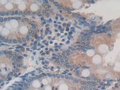 Immunohistochemistry-Paraffin: IL-24 Antibody (C7) [NBP3-42153] - DAB staining on IHC-P; Sample: Rat Small intestine Tissue; Primary Ab: 30ug/ml NBP3-42153; Second Ab: 2ug/mL HRP-Linked Caprine Anti-Mouse IgG Polyclonal Antibody