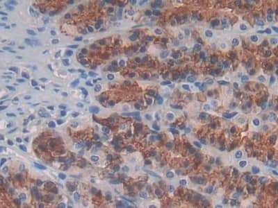 Immunohistochemistry-Paraffin: IL-24 Antibody (C7) [NBP3-42153] - DAB staining on IHC-P; Sample: Rat Stomach Tissue; Primary Ab: 30ug/ml NBP3-42153; Second Ab: 2ug/mL HRP-Linked Caprine Anti-Mouse IgG Polyclonal Antibody