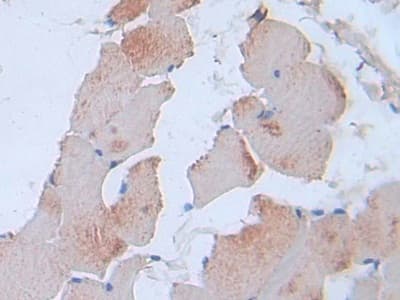 Immunohistochemistry-Paraffin: IL-24 Antibody (C7) [NBP3-42153] - DAB staining on IHC-P; Sample: Rat Skin Tissue; Primary Ab: 30ug/ml NBP3-42153; Second Ab: 2ug/mL HRP-Linked Caprine Anti-Mouse IgG Polyclonal Antibody