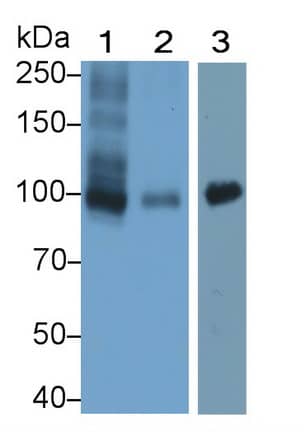 Western Blot: WFS1 Antibody (C3) [NBP3-42154] - Sample: Lane1: Rat Cerebrum lysate; Lane2: Mouse Cerebrum lysate; Lane3: Human Placenta lysate Primary Ab: 1ug/ml NBP3-42154; Second Ab: 0.2ug/mL HRP-Linked Caprine Anti-Mouse IgG Polyclonal Antibody