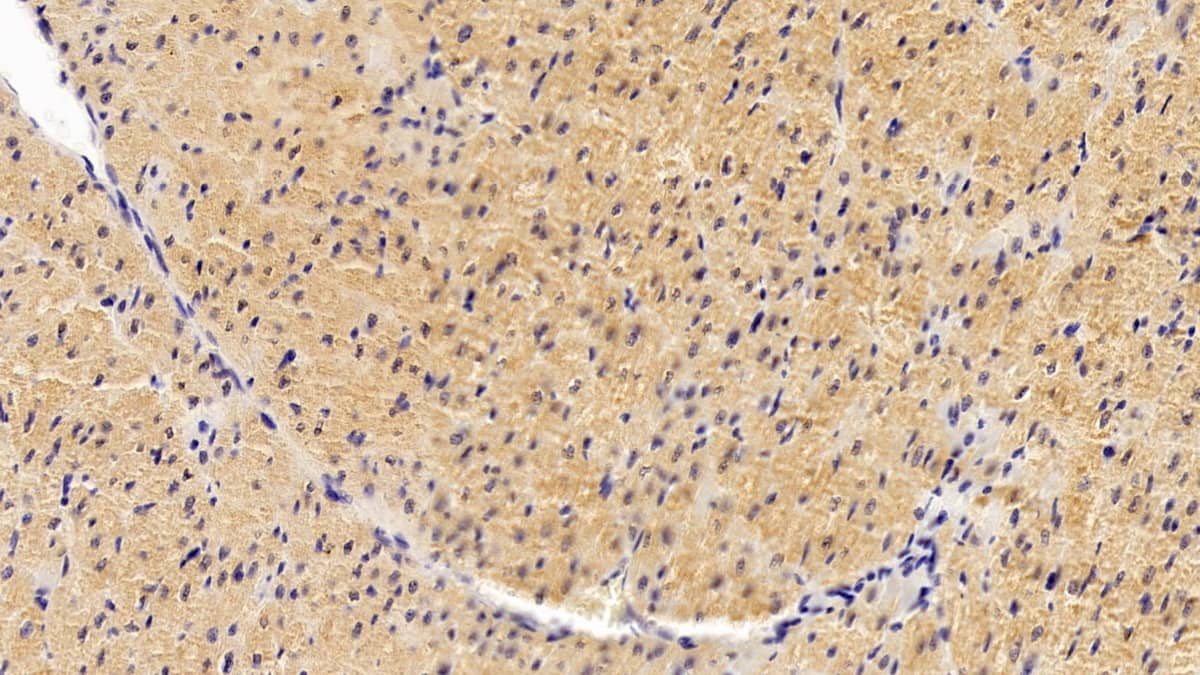 Immunohistochemistry-Paraffin: WFS1 Antibody (C7) [NBP3-42155] - DAB staining on IHC-P; Sample: Human Cardiac Muscle Tissue; Primary Ab: 20ug/ml NBP3-42155; Second Ab: 2ug/mL HRP-Linked Caprine Anti-Mouse IgG Polyclonal Antibody