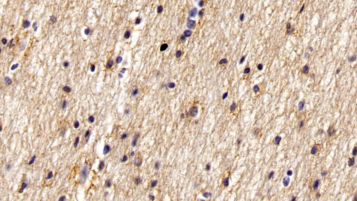 Immunohistochemistry-Paraffin: WFS1 Antibody (C15) [NBP3-42156] - DAB staining on IHC-P; Sample: Human Cerebrum Tissue; Primary Ab: 20ug/ml NBP3-42156; Second Ab: 2ug/mL HRP-Linked Caprine Anti-Mouse IgG Polyclonal Antibody