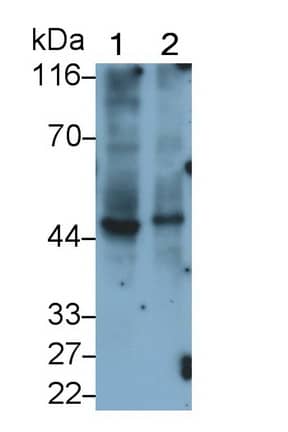 Western Blot: Peptidase Inhibitor 16/PI16 Antibody (C13) [NBP3-42157] - Sample: Lane1: Hela cell lysate; Lane2: HepG2 cell lysate Primary Ab: 0.4ug/ml NBP3-42157; Second Ab: 0.2ug/mL HRP-Linked Caprine Anti-Mouse IgG Polyclonal Antibody