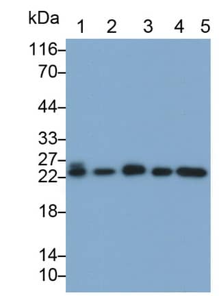 Western Blot: Gankyrin Antibody (C5) [NBP3-42158] - Sample: Lane1: Porcine Testis lysate; Lane2: A549 cell lysate; Lane3: HepG2 cell lysate; Lane4: K562 cell lysate; Lane5: PC3 cell lysate Primary Ab: 0.5ug/ml NBP3-42158; Second Ab: 0.2ug/mL HRP-Linked Caprine Anti-Mouse IgG Polyclonal Antibody