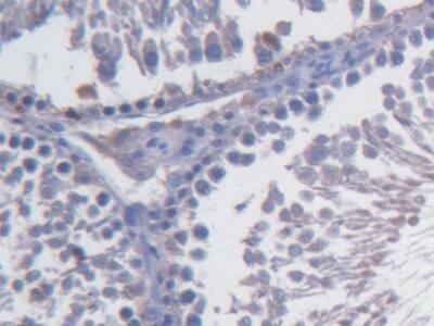 Immunohistochemistry-Paraffin: Fibulin 1 Antibody (C8) [NBP3-42159] - DAB staining on IHC-P; Sample: Rat Testis Tissue; Primary Ab: 20ug/ml NBP3-42159; Second Ab: 2ug/mL HRP-Linked Caprine Anti-Mouse IgG Polyclonal Antibody