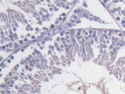 Immunohistochemistry-Paraffin: Fibulin 1 Antibody (C11) [NBP3-42160] - DAB staining on IHC-P; Sample: Rat Testis Tissue; Primary Ab: 20ug/ml NBP3-42160; Second Ab: 2ug/mL HRP-Linked Caprine Anti-Mouse IgG Polyclonal Antibody