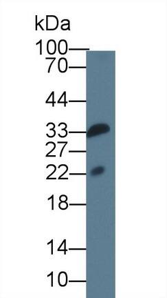 Western Blot: IL-36 gamma/IL-1F9 Antibody (D2) [NBP3-42161] - Sample: Rat Serum; Primary Ab: 3ug/ml NBP3-42161; Second Ab: 0.2ug/mL HRP-Linked Caprine Anti-Mouse IgG Polyclonal Antibody