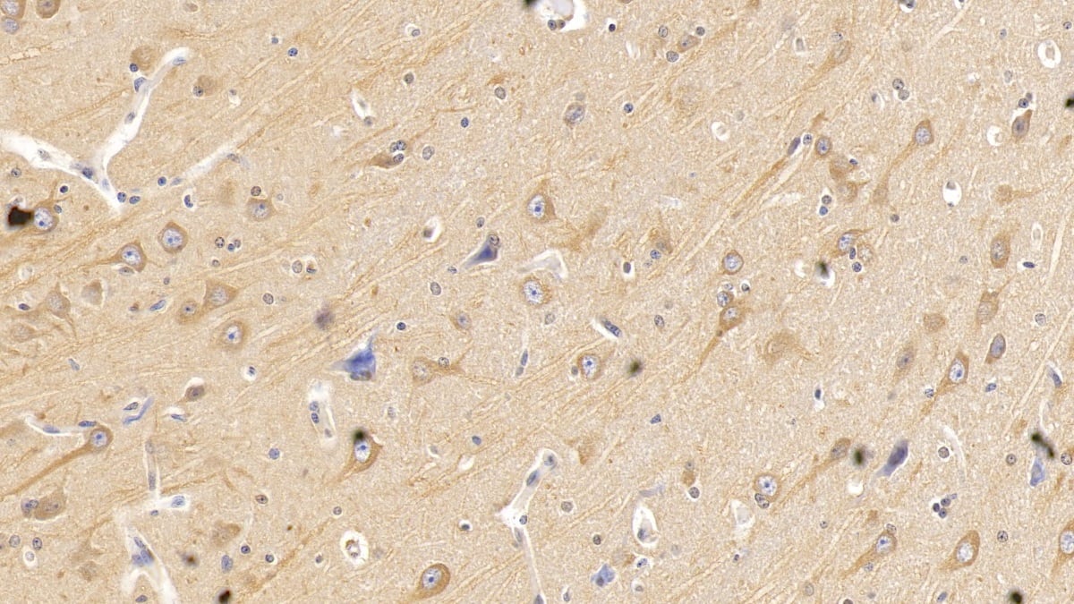 Immunohistochemistry-Paraffin: Semaphorin 5B Antibody (C11) [NBP3-42162] - DAB staining on IHC-P; Sample: Human Cerebrum Tissue; Primary Ab: 10ug/ml NBP3-42162; Second Ab: 2ug/mL HRP-Linked Caprine Anti-Mouse IgG Polyclonal Antibody