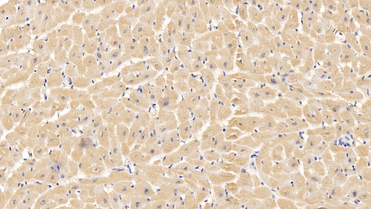 Immunohistochemistry-Paraffin: VDAC1 Antibody (C1) [NBP3-42163] - DAB staining on IHC-P; Sample: Human Cardiac Muscle Tissue; Primary Ab: 10ug/ml NBP3-42163; Second Ab: 2ug/mL HRP-Linked Caprine Anti-Mouse IgG Polyclonal Antibody