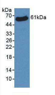 Western Blot: VDAC1 Antibody (C1) [NBP3-42163] - Sample: Recombinant VDAC1, Human.