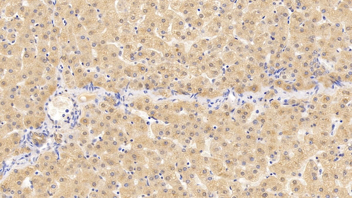 Immunohistochemistry-Paraffin: VDAC1 Antibody (C1) [NBP3-42163] - DAB staining on IHC-P; Sample: Human Liver Tissue; Primary Ab: 10ug/ml NBP3-42163; Second Ab: 2ug/mL HRP-Linked Caprine Anti-Mouse IgG Polyclonal Antibody