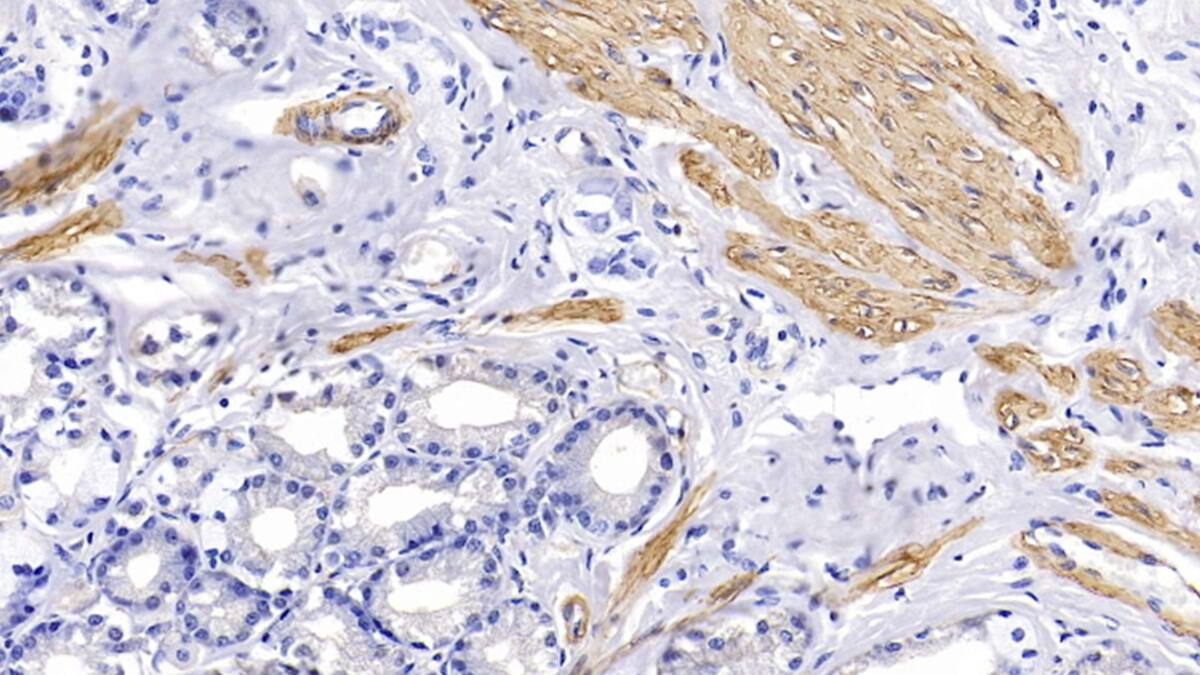 Immunohistochemistry-Paraffin: Actin Alpha 1 Cardiac Muscle Antibody (C3) [NBP3-42164] - DAB staining on IHC-P; Samples: Human Stomach Tissue; Primary Ab: 10ug/ml NBP3-42164; Second Ab: 2ug/mL HRP-Linked Caprine Anti-Mouse IgG Polyclonal Antibody