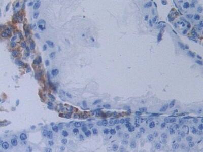 Immunohistochemistry-Paraffin METTL21C Antibody - BSA Free