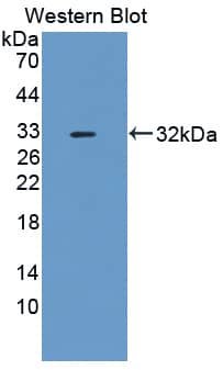 Western Blot: METTL21C Antibody [NBP3-42166] - Sample: Recombinant protein.