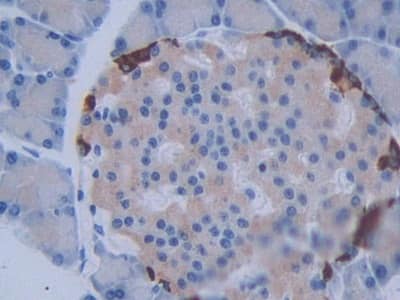 Immunohistochemistry-Paraffin: METTL21C Antibody [NBP3-42166] - DAB staining on IHC-P; Samples: Rat Pancreas Tissue; Primary Ab: 10ug/ml NBP3-42166; Second Ab: 2ug/mL HRP-Linked Caprine Anti-Rabbit IgG Polyclonal Antibody