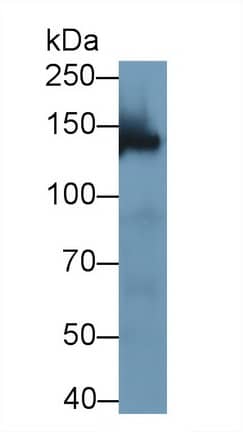 Western Blot: WWC3 Antibody [NBP3-42171] - Sample: Rat Cerebrum lysate Primary Ab: 2ug/ml NBP3-42171; Second Ab: 0.2ug/mL HRP-Linked Caprine Anti-Rabbit IgG Polyclonal Antibody