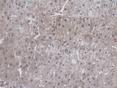 Immunohistochemistry-Paraffin: Cytochrome P450 3A7 Antibody (C1) [NBP3-42172] - DAB staining on IHC-P; Sample: Human Liver Tissue; Primary Ab: 20ug/ml NBP3-42172; Second Ab: 2ug/mL HRP-Linked Caprine Anti-Mouse IgG Polyclonal Antibody
