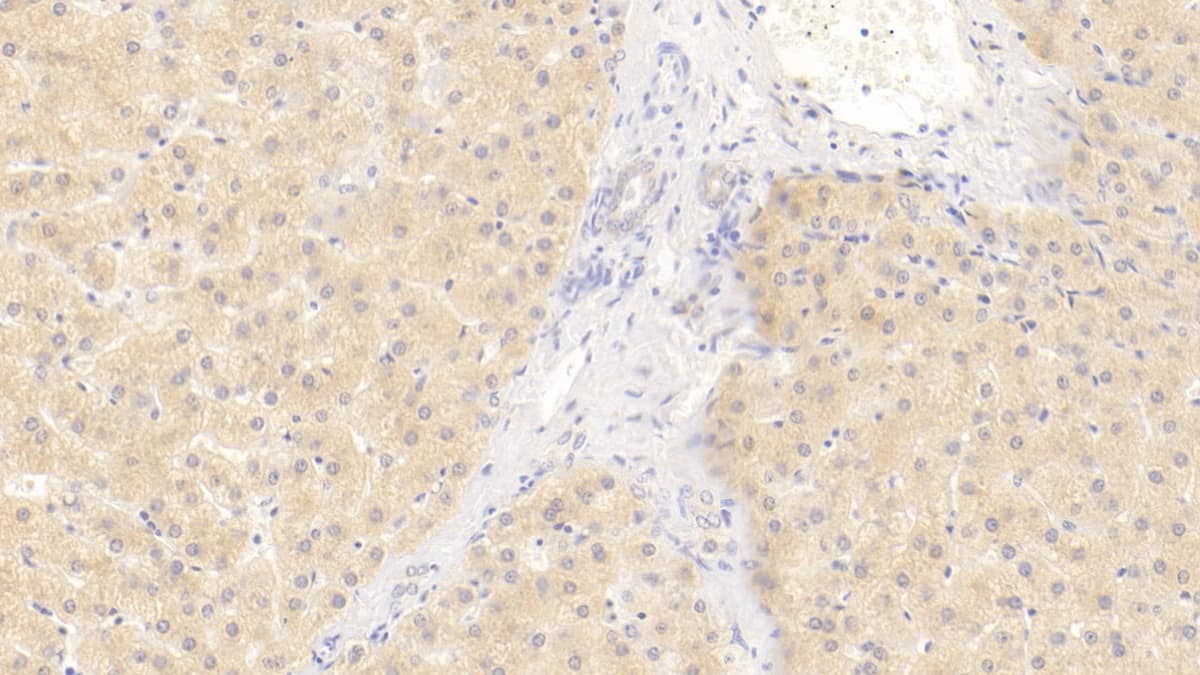 Immunohistochemistry-Paraffin: Wnt-11 Antibody (D6) [NBP3-42175] - DAB staining on IHC-P; Sample: Human Liver Tissue; Primary Ab: 20ug/ml NBP3-42175; Second Ab: 2ug/mL HRP-Linked Caprine Anti-Mouse IgG Polyclonal Antibody