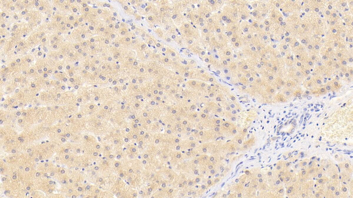 Immunohistochemistry-Paraffin: Wnt-11 Antibody (D8) [NBP3-42176] - DAB staining on IHC-P; Sample: Human Liver Tissue; Primary Ab: 20ug/ml NBP3-42176; Second Ab: 2ug/mL HRP-Linked Caprine Anti-Mouse IgG Polyclonal Antibody