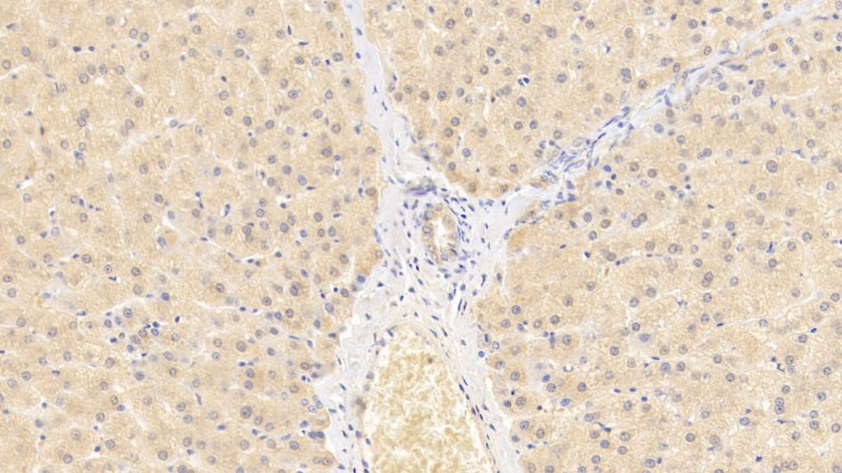 Immunohistochemistry-Paraffin: Wnt-11 Antibody (D10) [NBP3-42177] - DAB staining on IHC-P; Sample: Human Liver Tissue; Primary Ab: 20ug/ml NBP3-42177; Second Ab: 2ug/mL HRP-Linked Caprine Anti-Mouse IgG Polyclonal Antibody