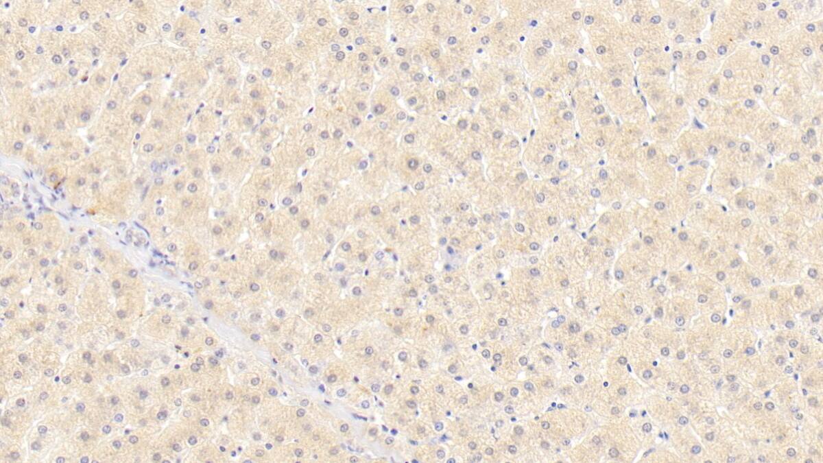 Immunohistochemistry-Paraffin: Wnt-11 Antibody (D11) [NBP3-42178] - DAB staining on IHC-P; Sample: Human Liver Tissue; Primary Ab: 20ug/ml NBP3-42178; Second Ab: 2ug/mL HRP-Linked Caprine Anti-Mouse IgG Polyclonal Antibody