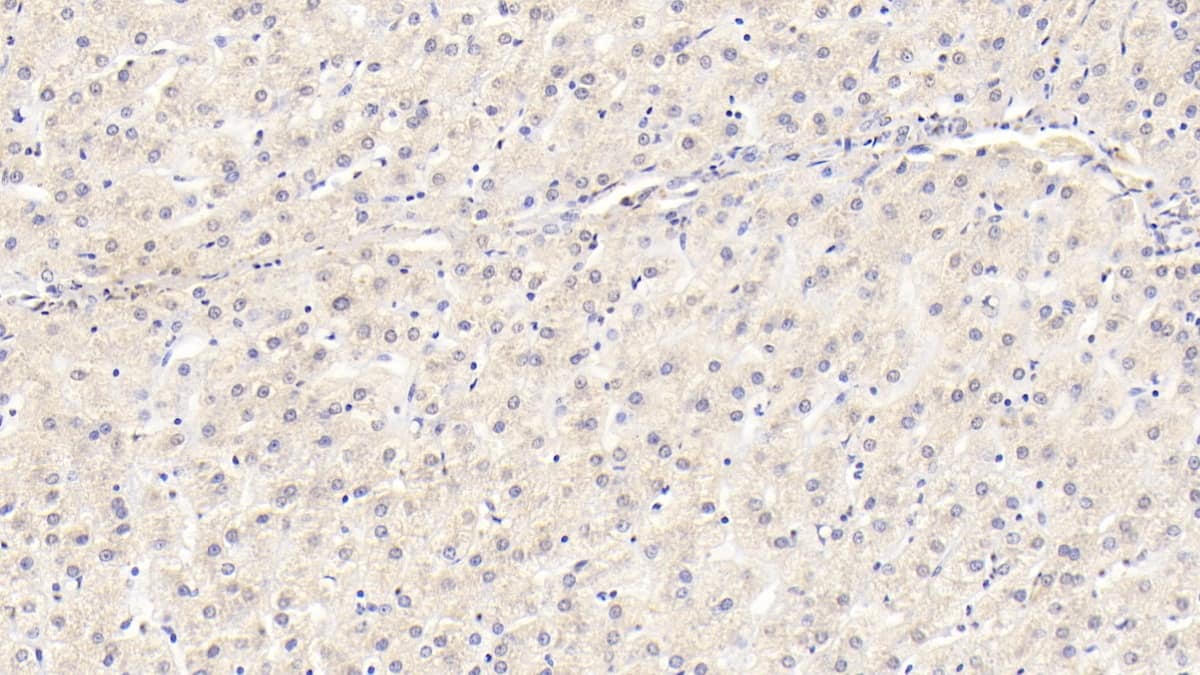 Immunohistochemistry-Paraffin: Wnt-11 Antibody (D13) [NBP3-42179] - DAB staining on IHC-P; Sample: Human Liver Tissue; Primary Ab: 20ug/ml NBP3-42179; Second Ab: 2ug/mL HRP-Linked Caprine Anti-Mouse IgG Polyclonal Antibody