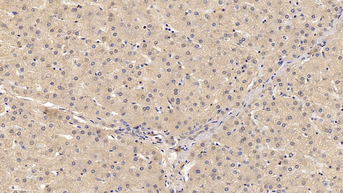 Immunohistochemistry-Paraffin: Wnt-4 Antibody (C2) [NBP3-42180] - DAB staining on IHC-P; Sample: Human Liver Tissue; Primary Ab: 10ug/ml NBP3-42180; Second Ab: 2ug/mL HRP-Linked Caprine Anti-Mouse IgG Polyclonal Antibody