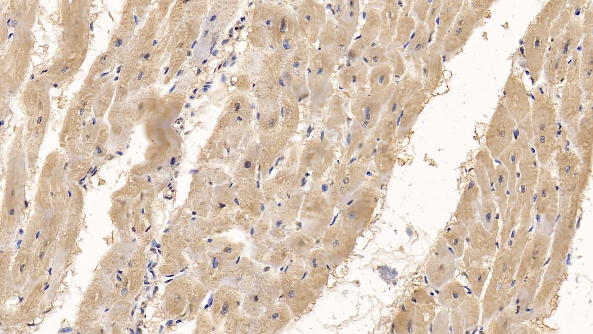 Immunohistochemistry-Paraffin: Wnt-4 Antibody (C2) [NBP3-42180] - DAB staining on IHC-P; Sample: Human Cardiac Muscle Tissue; Primary Ab: 10ug/ml NBP3-42180; Second Ab: 2ug/mL HRP-Linked Caprine Anti-Mouse IgG Polyclonal Antibody