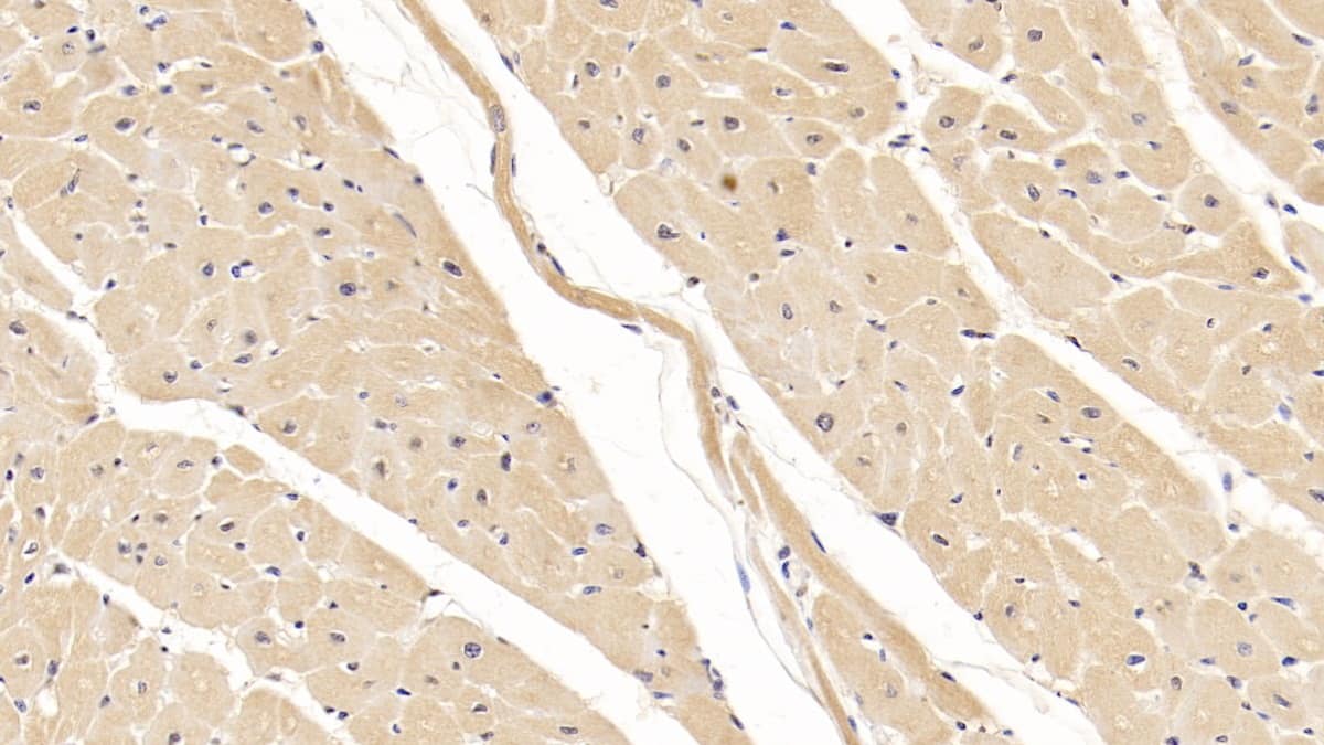 Immunohistochemistry-Paraffin: Wnt-4 Antibody (D11) [NBP3-42181] - DAB staining on IHC-P; Sample: Human Cardiac Muscle Tissue; Primary Ab: 30ug/ml NBP3-42181; Second Ab: 2ug/mL HRP-Linked Caprine Anti-Mouse IgG Polyclonal Antibody