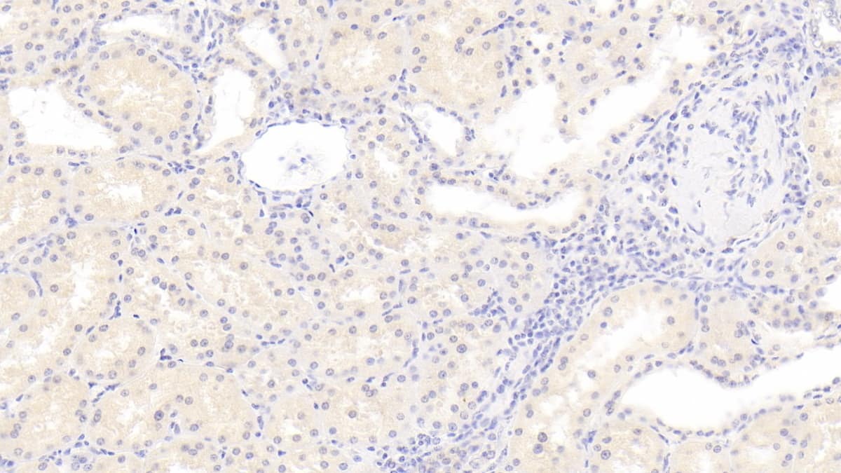 Immunohistochemistry-Paraffin: RHD Antibody (C1) [NBP3-42182] - DAB staining on IHC-P; Sample: Human Kidney Tissue; Primary Ab: 20ug/ml NBP3-42182; Second Ab: 2ug/mL HRP-Linked Caprine Anti-Mouse IgG Polyclonal Antibody