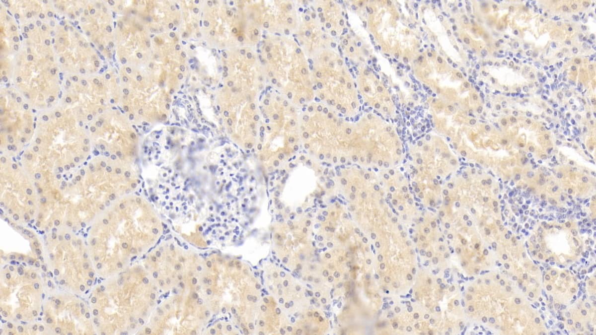 Immunohistochemistry-Paraffin: RHD Antibody (C7) [NBP3-42183] - DAB staining on IHC-P; Sample: Human Kidney Tissue; Primary Ab: 20ug/ml NBP3-42183; Second Ab: 2ug/mL HRP-Linked Caprine Anti-Mouse IgG Polyclonal Antibody