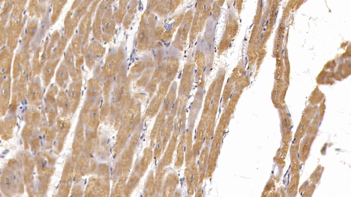 Immunohistochemistry-Paraffin: Semaphorin 5B Antibody (C15) [NBP3-42184] - DAB staining on IHC-P; Sample: Human Cardiac Muscle Tissue; Primary Ab: 10ug/ml NBP3-42184; Second Ab: 2ug/mL HRP-Linked Caprine Anti-Mouse IgG Polyclonal Antibody