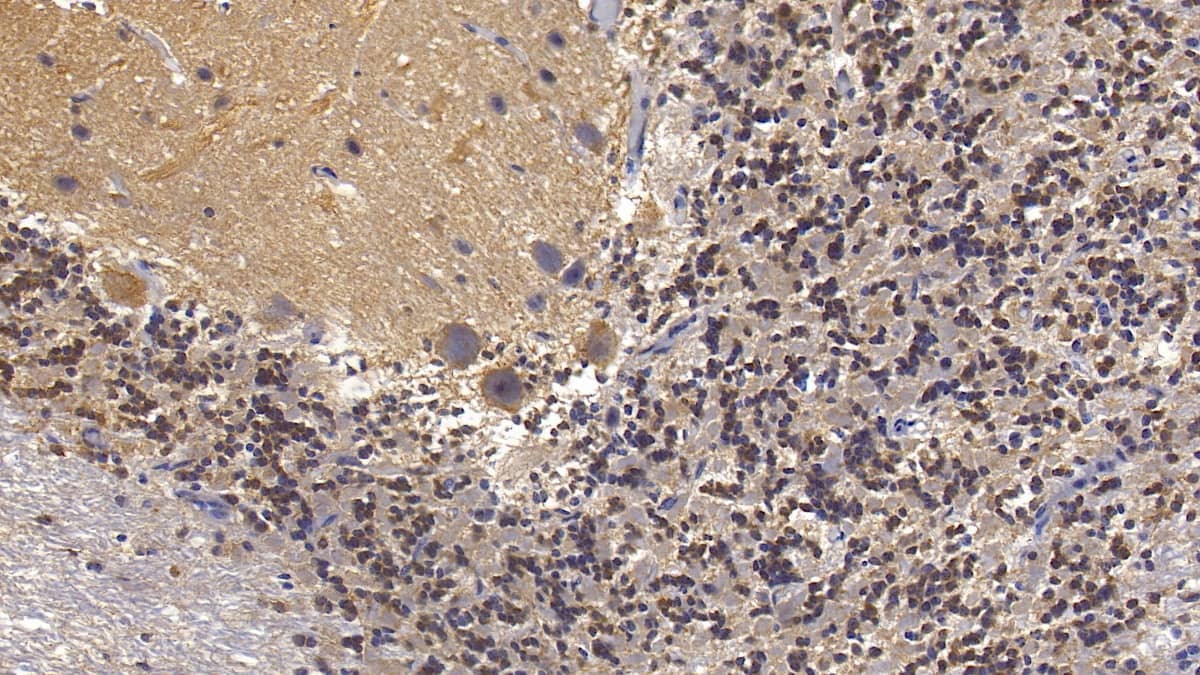 Immunohistochemistry-Paraffin: Semaphorin 5B Antibody (C15) [NBP3-42184] - DAB staining on IHC-P; Sample: Human Cerebellum Tissue; Primary Ab: 10ug/ml NBP3-42184; Second Ab: 2ug/mL HRP-Linked Caprine Anti-Mouse IgG Polyclonal Antibody