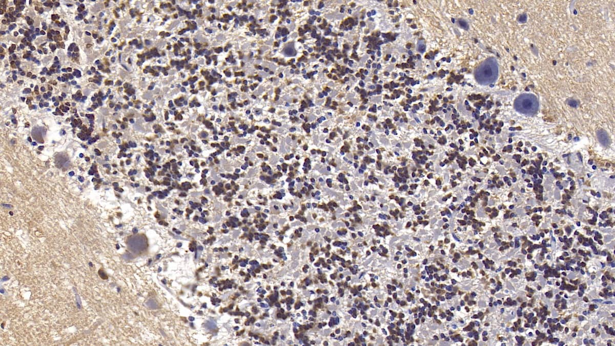 Immunohistochemistry-Paraffin Semaphorin 5B Antibody (C17) - BSA Free