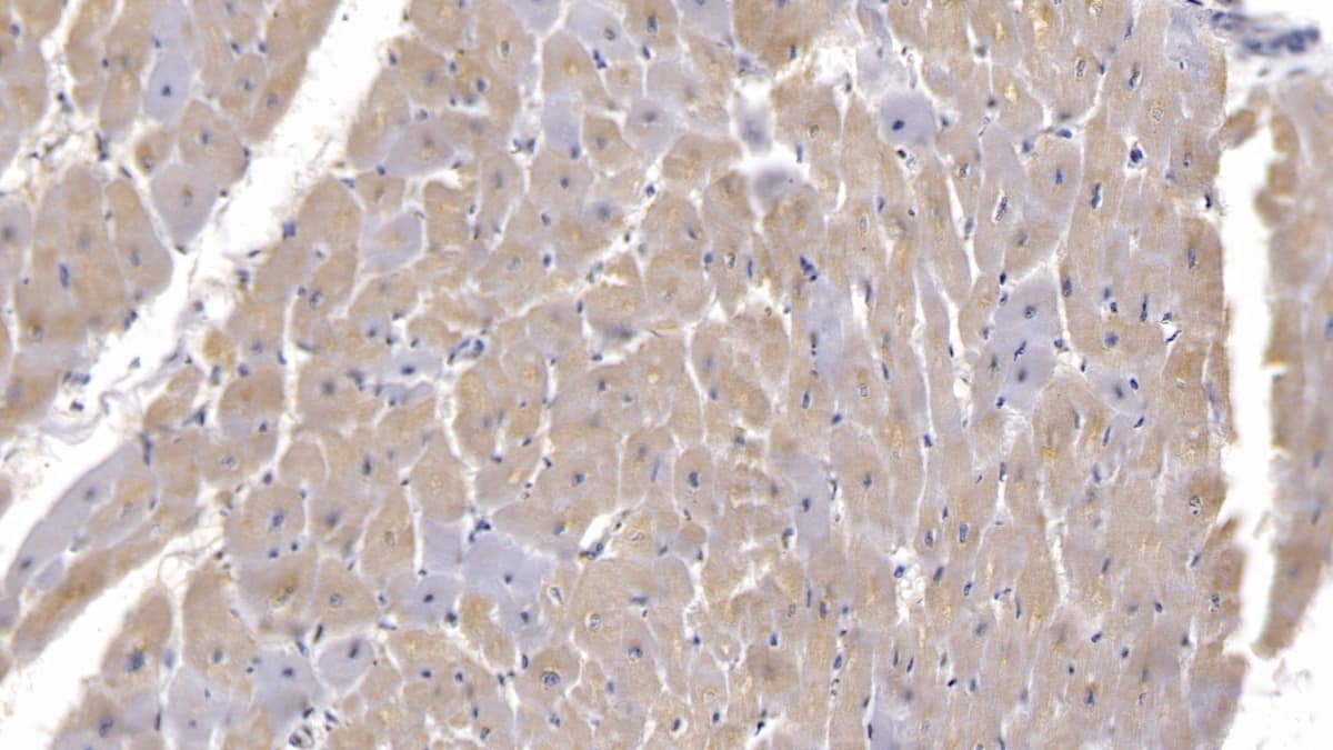 Immunohistochemistry-Paraffin Semaphorin 5B Antibody (C17) - BSA Free