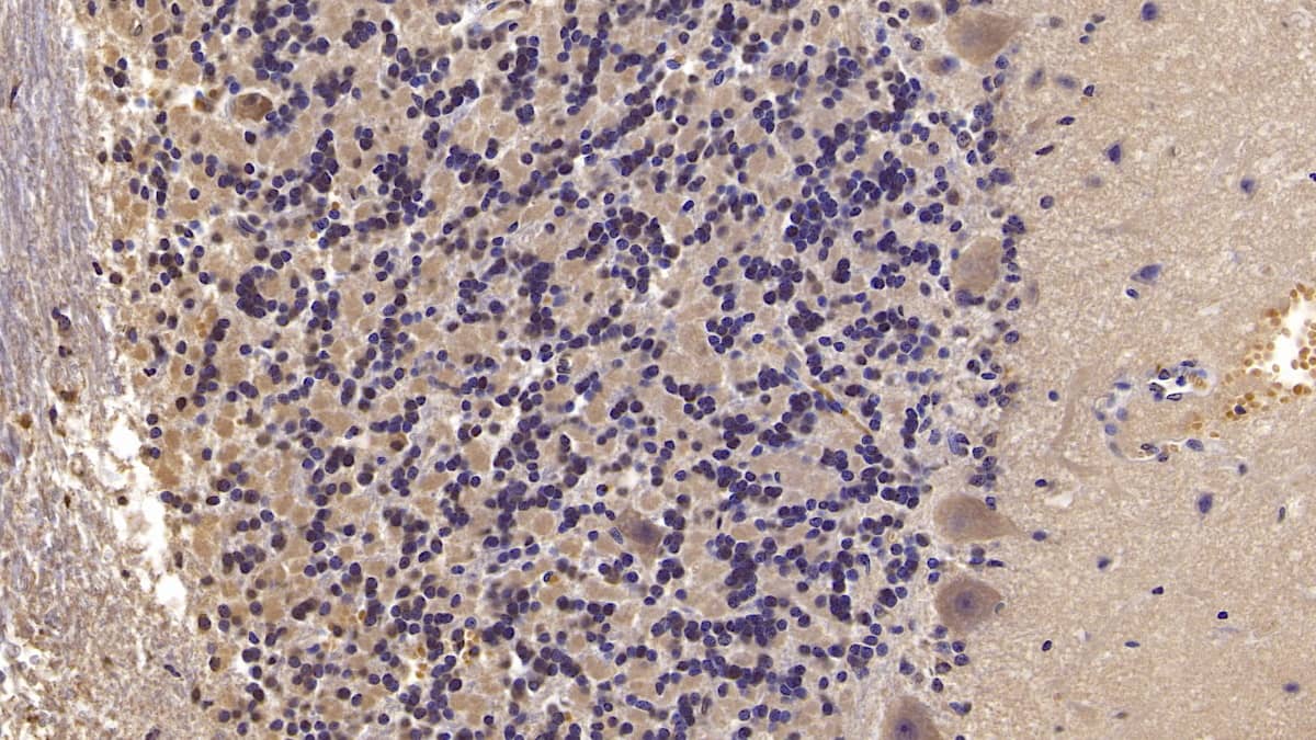 Immunohistochemistry-Paraffin Semaphorin 5B Antibody (C4) - BSA Free