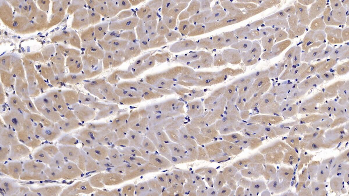 Immunohistochemistry-Paraffin Semaphorin 5B Antibody (C4) - BSA Free