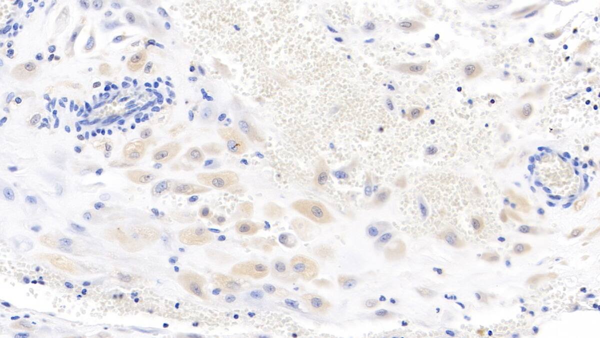 Immunohistochemistry-Paraffin: Wnt-3a Antibody (C1) [NBP3-42187] - DAB staining on IHC-P; Samples: Human Placenta Tissue; Primary Ab: 10ug/ml NBP3-42187; Second Ab: 2ug/mL HRP-Linked Caprine Anti-Mouse IgG Polyclonal Antibody