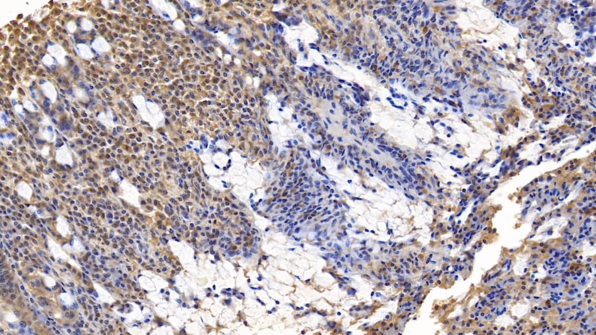 Immunohistochemistry-Paraffin: Wnt-3a Antibody (D1) [NBP3-42188] - DAB staining on IHC-P; Sample: Human Small intestine Tissue; Primary Ab: 10ug/ml NBP3-42188; Second Ab: 2ug/mL HRP-Linked Caprine Anti-Mouse IgG Polyclonal Antibody