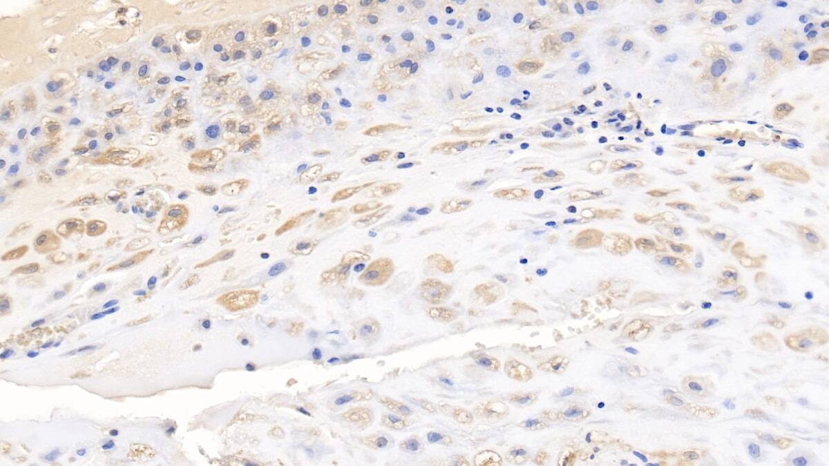 Immunohistochemistry-Paraffin: Wnt-3a Antibody (D1) [NBP3-42188] - DAB staining on IHC-P; Sample: Human Placenta Tissue; Primary Ab: 10ug/ml NBP3-42188; Second Ab: 2ug/mL HRP-Linked Caprine Anti-Mouse IgG Polyclonal Antibody