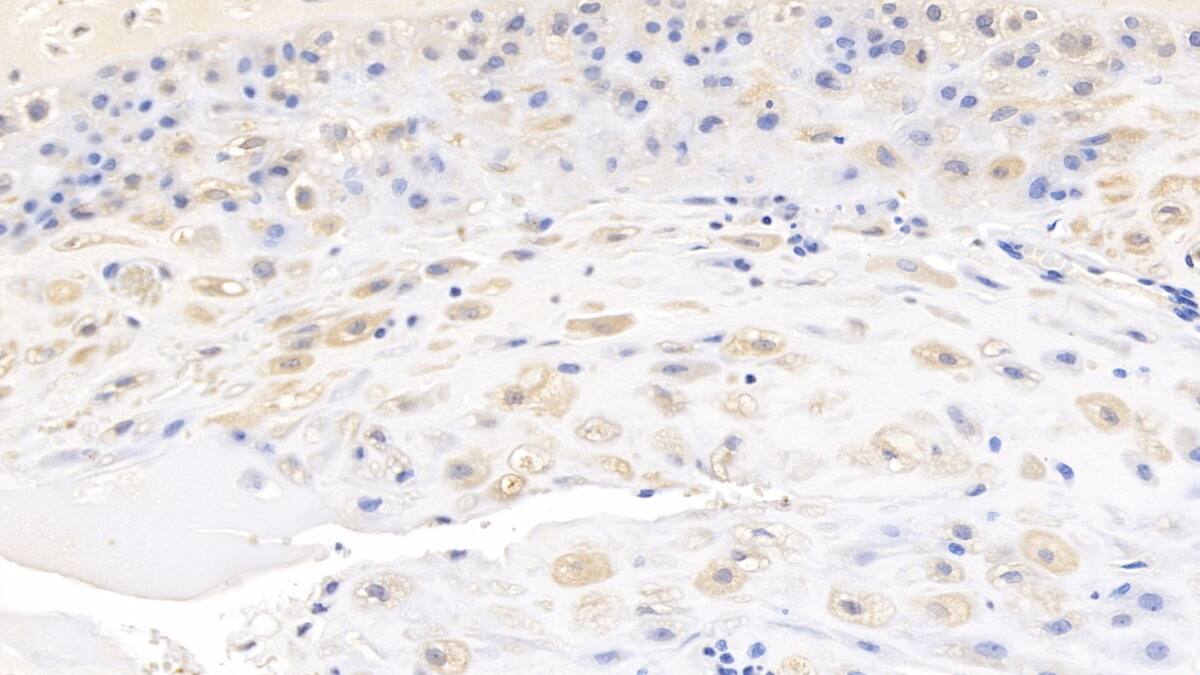 Immunohistochemistry-Paraffin: Wnt-3a Antibody (D4) [NBP3-42189] - DAB staining on IHC-P; Sample: Human Placenta Tissue; Primary Ab: 10ug/ml NBP3-42189; Second Ab: 2ug/mL HRP-Linked Caprine Anti-Mouse IgG Polyclonal Antibody