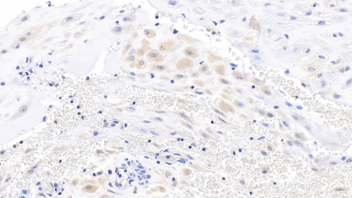 Immunohistochemistry-Paraffin: Wnt-3a Antibody (C15) [NBP3-42190] - DAB staining on IHC-P; Sample: Human Placenta Tissue; Primary Ab: 10ug/ml NBP3-42190; Second Ab: 2ug/mL HRP-Linked Caprine Anti-Mouse IgG Polyclonal Antibody