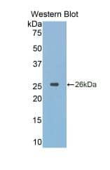 Western Blot: Cathepsin K Antibody (1#) [NBP3-42193] - Sample: Recombinant Cathepsin K, Simian.