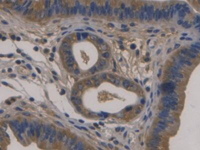 Immunohistochemistry-Paraffin: Fibulin 1 Antibody (C12) [NBP3-42195] - DAB staining on IHC-P; Samples: Mouse Uterus Tissue; Primary Ab: 30ug/ml NBP3-42195; Second Ab: 2ug/mL HRP-Linked Caprine Anti-Mouse IgG Polyclonal Antibody