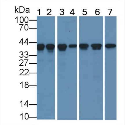 Western Blot: Actin Alpha 1 Cardiac Muscle Antibody (C4) [NBP3-42196] - Sample: Lane1: Mouse Skeletal muscle lysate; Lane2: Porcine Heart lysate; Lane3: Porcine Skeletal muscle lysate; Lane4: Canine Heart lysate; Lane5: Gallus Skeletal muscle lysate; Lane6: Bovine Heart lysate; Lane7: Rabbit Skeletal muscle lysate Primary Ab: 0.5ug/ml NBP3-42196; Second Ab: 0.2ug/mL HRP-Linked Caprine Anti-Mouse IgG Polyclonal Antibody