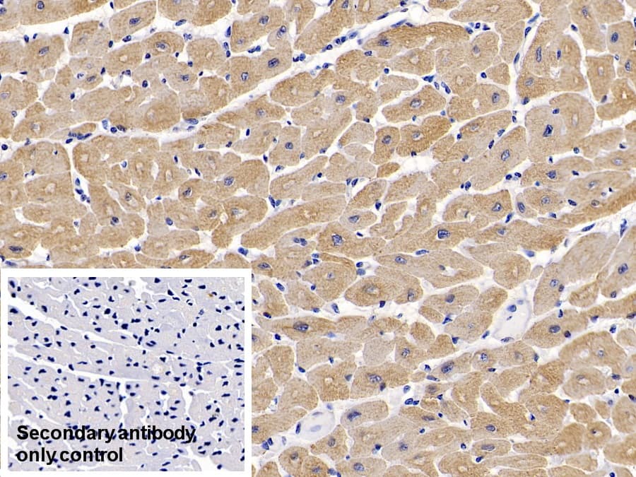 Immunohistochemistry-Paraffin: Actin Alpha 1 Cardiac Muscle Antibody (C4) [NBP3-42196] - DAB staining on IHC-P; Sample: Human Cardiac Muscle Tissue; Primary Ab: 10ug/ml NBP3-42196; Second Ab: 2ug/mL HRP-Linked Caprine Anti-Mouse IgG Polyclonal Antibody